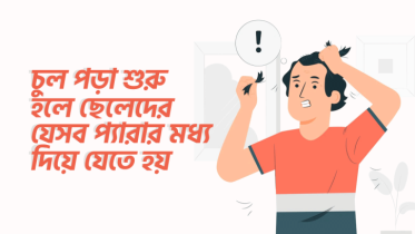 একবার চুল পড়া শুরু হলে ছেলেদের যে ১০টি প্যারার মধ্য দিয়ে যেতে হয়